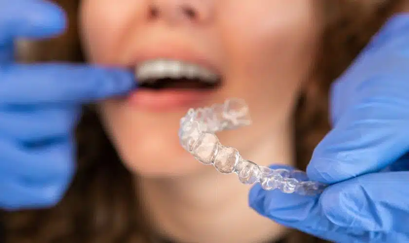 Invisalign in Dallas: Beyond Cosmetic Benefits