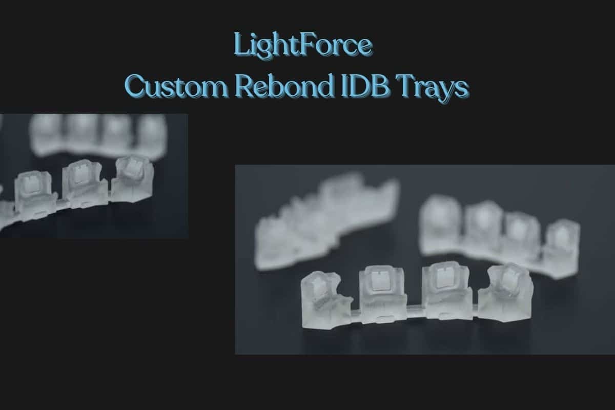 What are the Benefits of Custom Rebond IDB Trays?